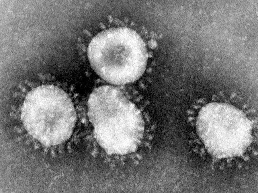 coronavirus