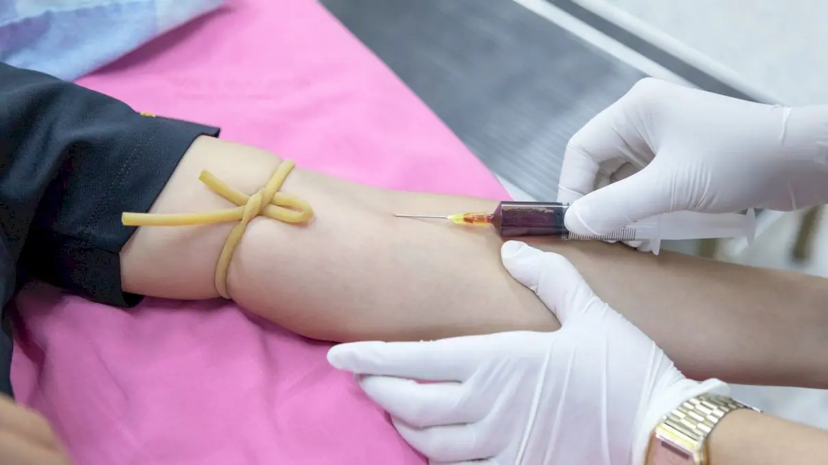 Ce este creatinina? Ce este un test de sânge la creatinină?