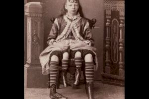 Care este povestea lui Myrtle Corbin, femeia cu patru picioare?