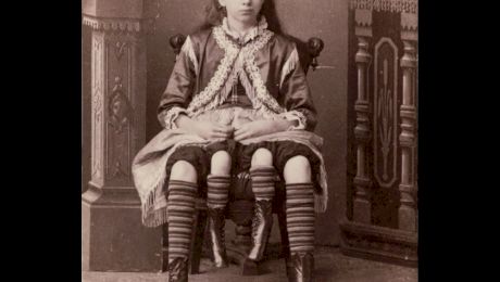 Care este povestea lui Myrtle Corbin, femeia cu patru picioare?