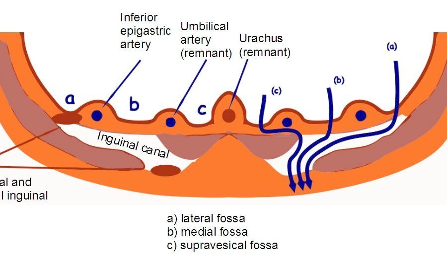 Inguinal_fossae