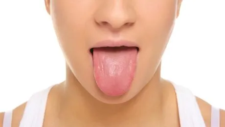 Curiozități despre limba ta. Cum pot detecta medicii anumite boli uitându-se la limbă