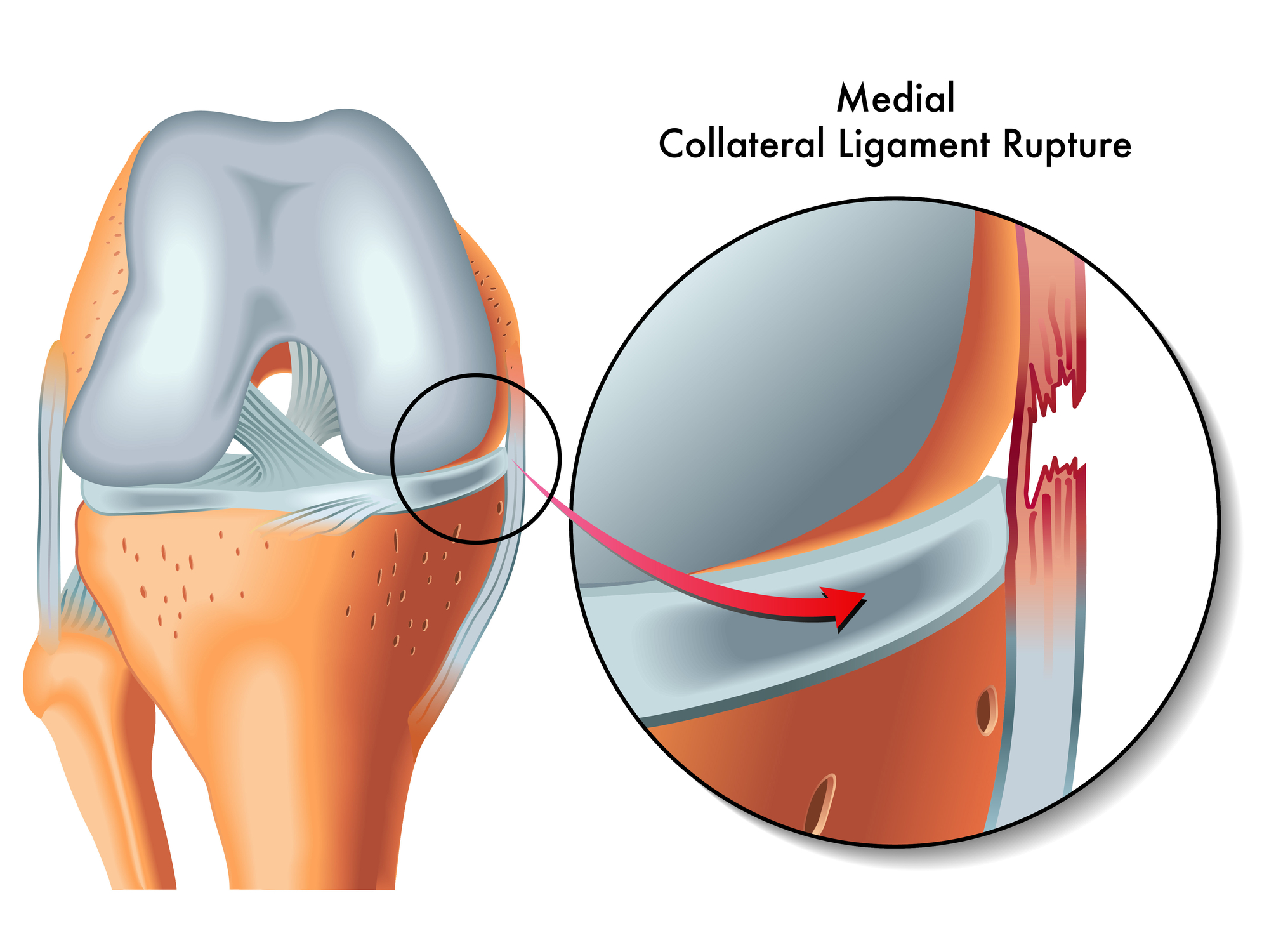 ligamente