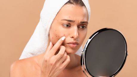 Cât de periculoasă este acneea netratată?