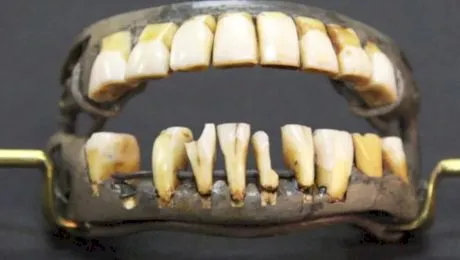 Avea George Washington, primul președinte al Statelor Unite ale Americii, dinți de lemn?