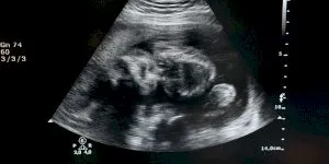 Povestea bărbatului care este, genetic, propriul unchi al fiului lui